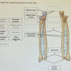 Correctly label the anatomical features of the ulna